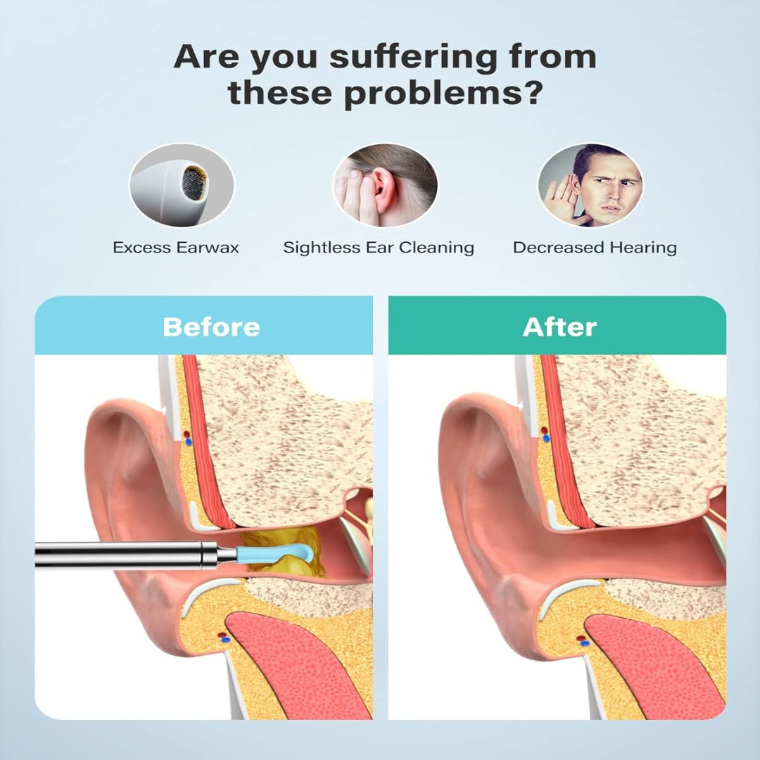 Ear Camera